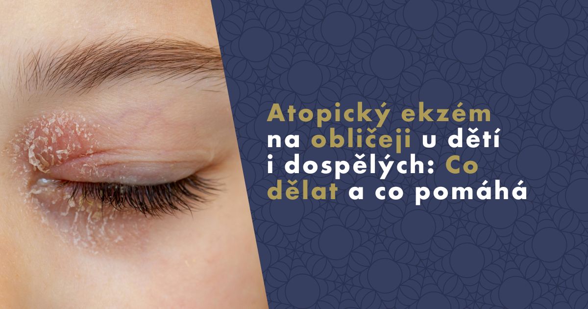 atopicky-ekzem-na-obliceji (1)